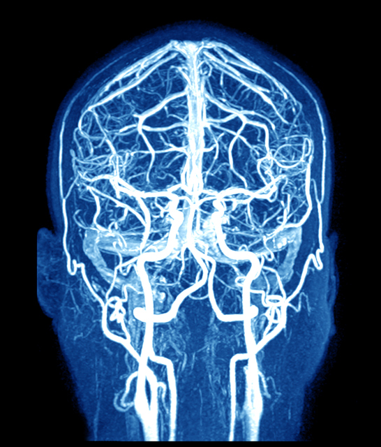 MRI možganov in možganskih žil