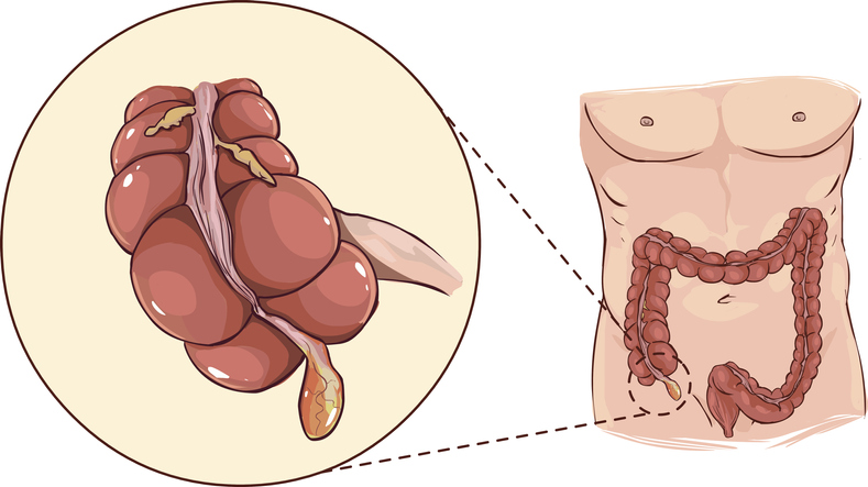 Dodatek - anatomski prikaz na začetku debelega črevesa