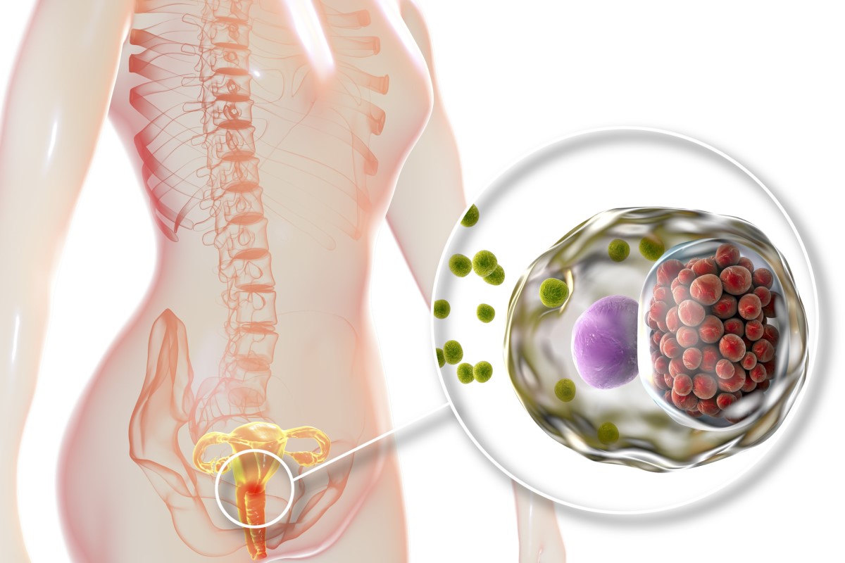 Okužba je zajela maternični vrat - anatomski prikaz ženskega reproduktivnega sistema