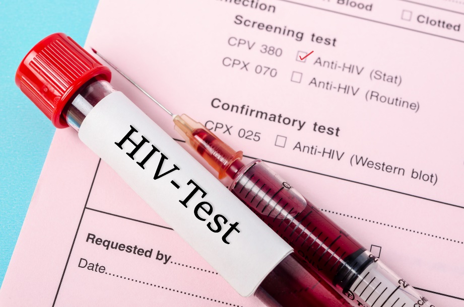 Diagnostični test za ugotavljanje prisotnosti protiteles anti-HIV v bolnikovem vzorcu krvi