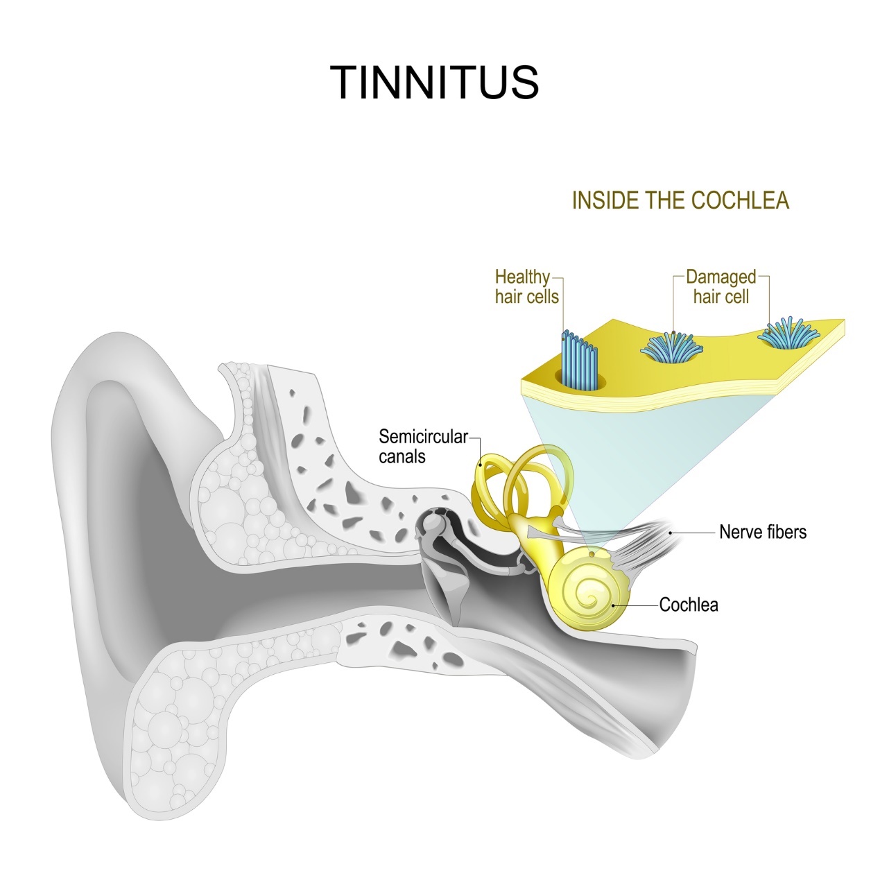 Notranje uho in tinitus - piskanje in šumenje v ušesu